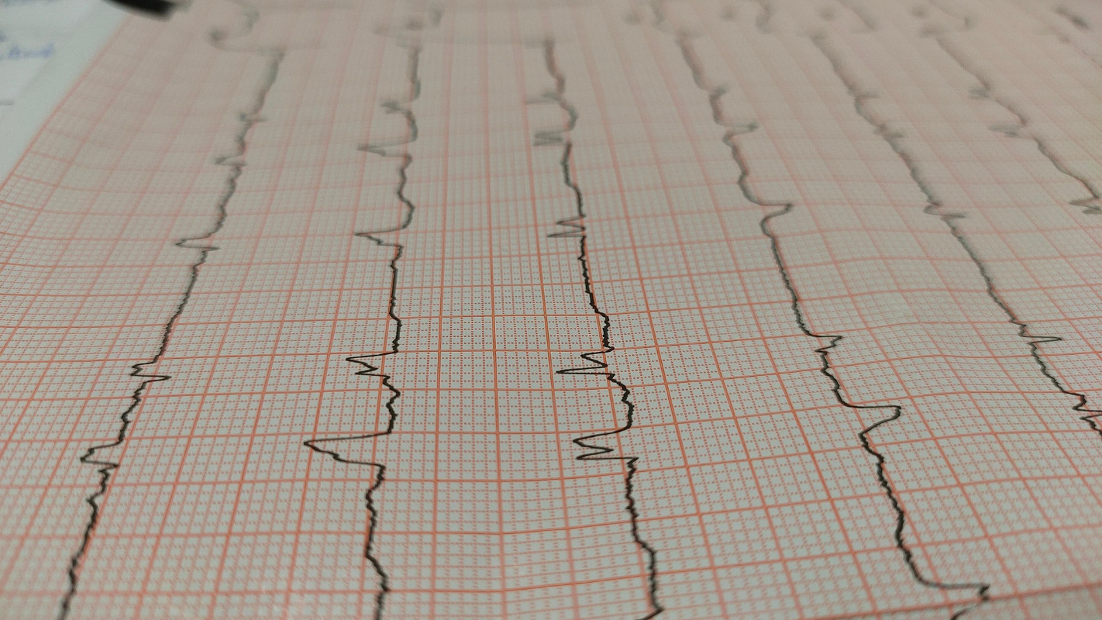 Kadınlarda kalp krizinin nedenleri erkeklerden farklı Kadınlarda kalp krizinin nedenleri erkeklerden farklı