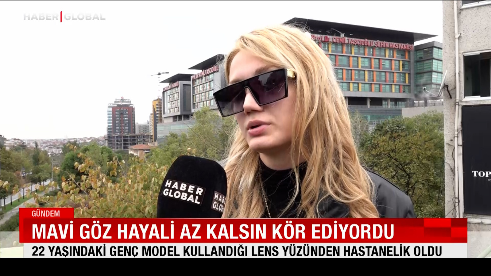 22 yaşındaki genç model kullandığı lens yüzünden hastanelik oldu 22 yaşındaki genç model kullandığı lens yüzünden hastanelik oldu