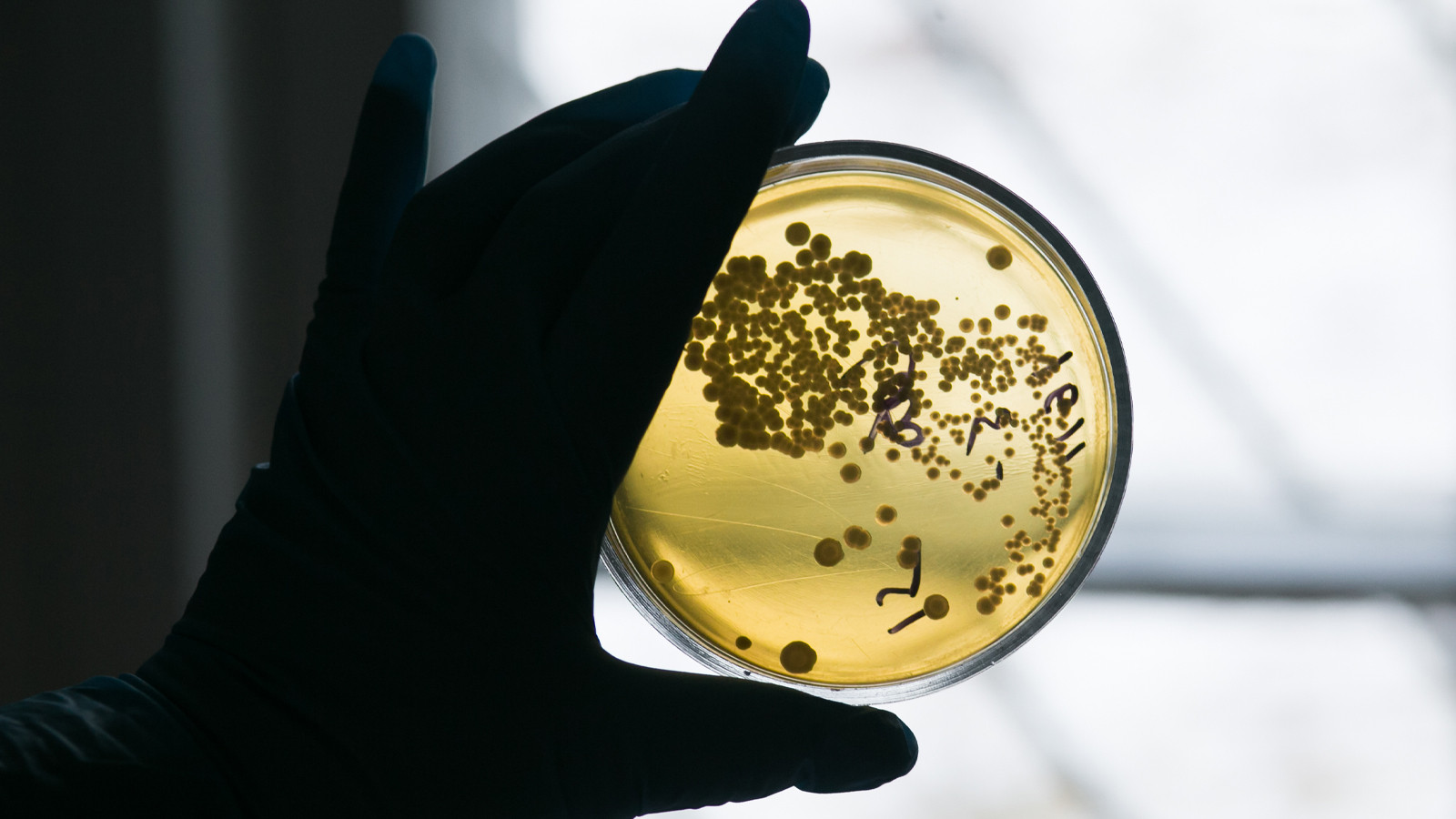 Yeni salgın 2 can aldı: En çok çocukları etkiliyor! Yeni salgın 2 can aldı: En çok çocukları etkiliyor!